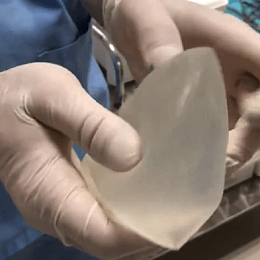 Проверка силиконового импланта на прочность: до и после